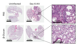 Nature Immunology:重新平衡免疫系統(tǒng)