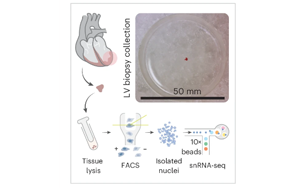 Nature Cardiovascular Research:心臟炎癥的關(guān)鍵差異
